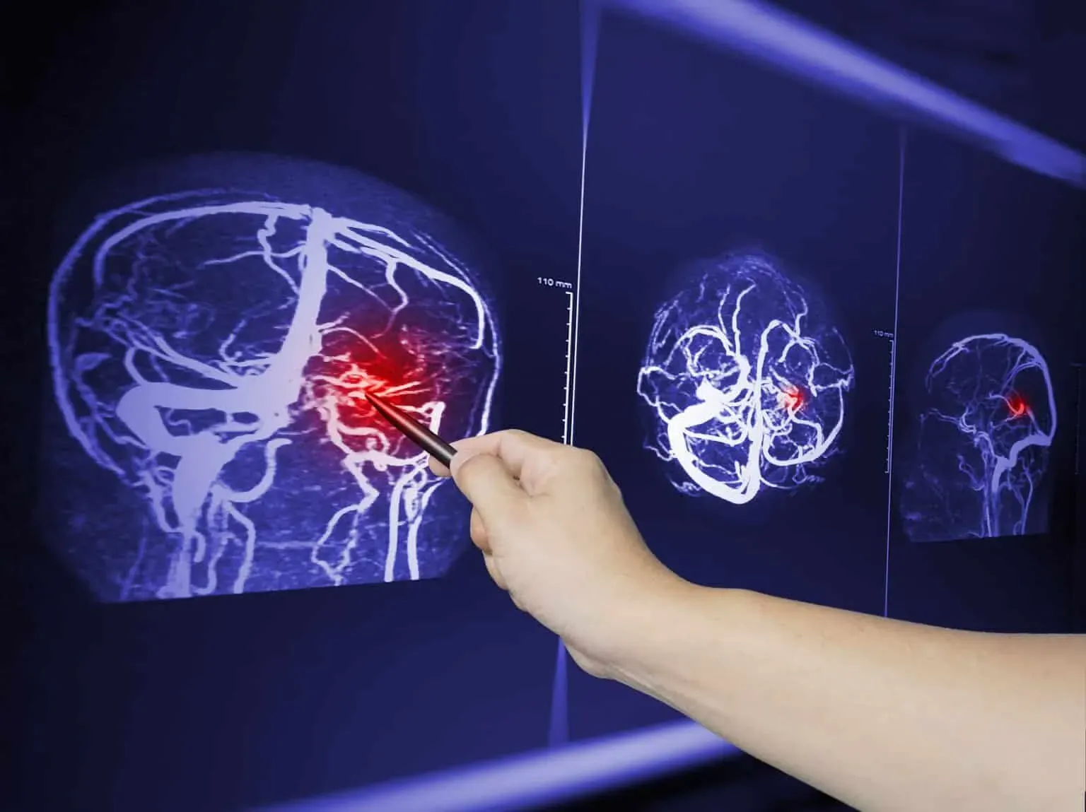 bigstock-Close-Up-Hand-Doctor-Point-Mra-429813824-min-1536x1149.webp
