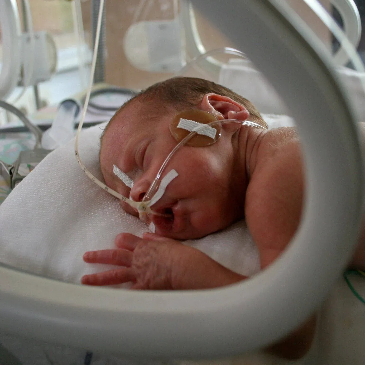 bigstock-Neonate-In-Incubator-113147-min-1536x1536.webp