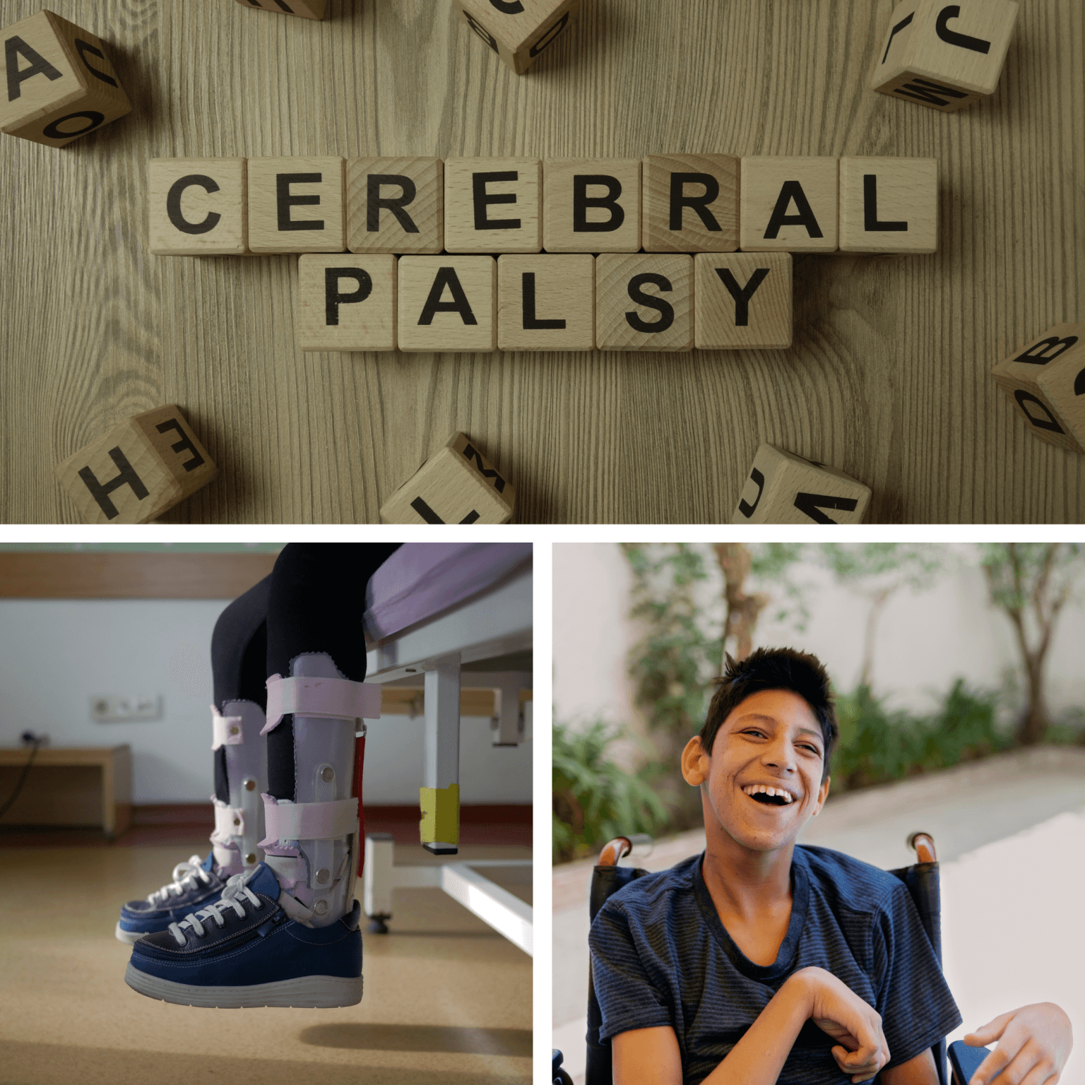 Cerebral-Palsy