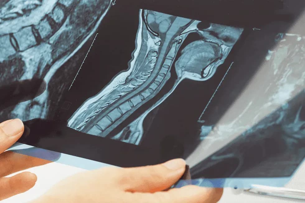 doctors-hands-holding-x-ray-980x653.webp